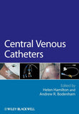Central Venous Catheters: 26 Paperback